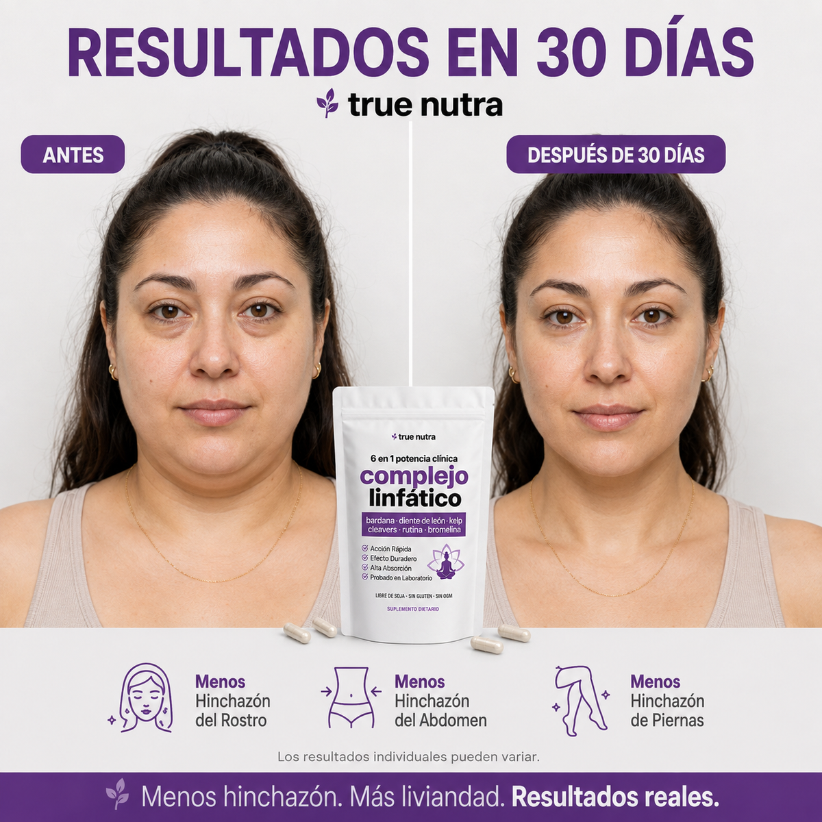 TrueNutra™ | Cápsulas que Drenan Naturalmente la Hinchazón del Rostro, Abdomen y Piernas