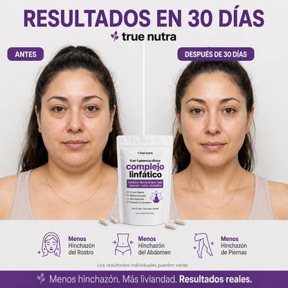 TrueNutra™ | Cápsulas que Drenan Naturalmente la Hinchazón del Rostro, Abdomen y Piernas